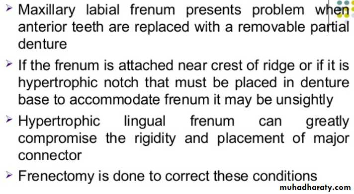 mouth preparation for removable partial denture
