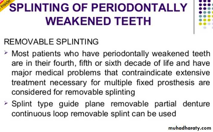 mouth preparation for removable partial denture