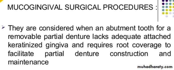 mouth preparation for removable partial denture