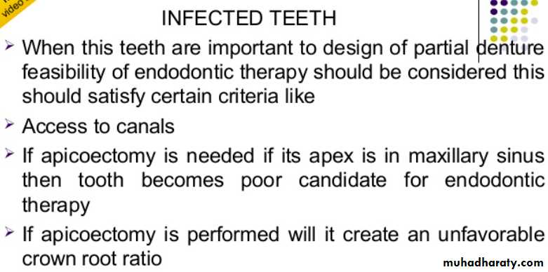mouth preparation for removable partial denture