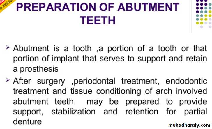 mouth preparation for removable partial denture