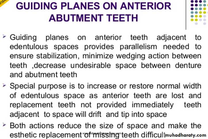 mouth preparation for removable partial denture
