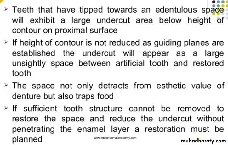 mouth preparation for removable partial denture