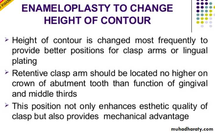 mouth preparation for removable partial denture