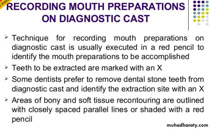 mouth preparation for removable partial denture