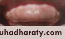 classification of periodontal disease