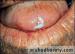 classification of periodontal disease