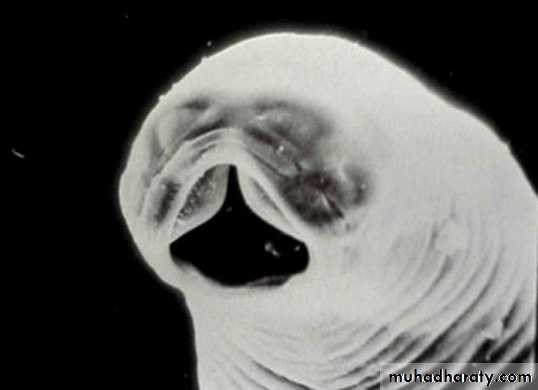 Hookworms Necator americanous
