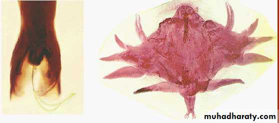 Hookworms Necator americanous