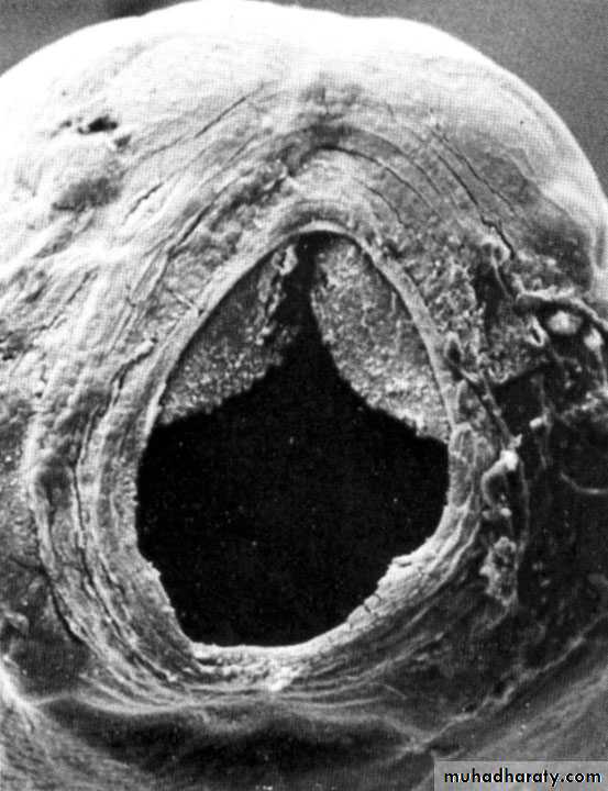 Hookworms Necator americanous