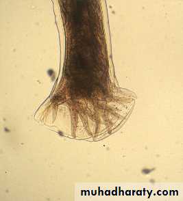 Hookworms Necator americanous