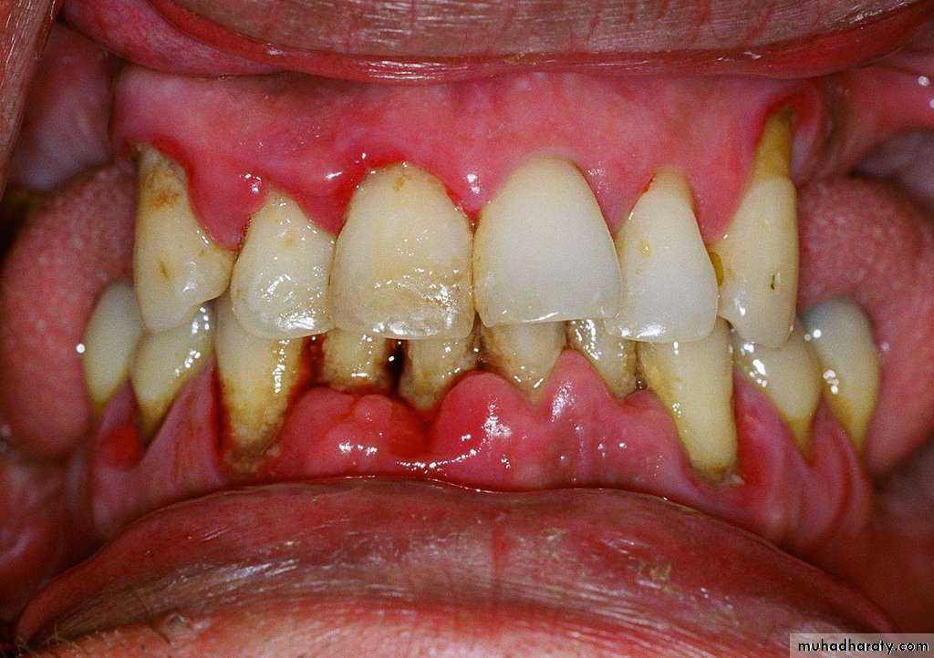 primary health care