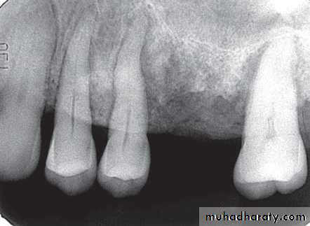 Inflametary lesions of the jaw