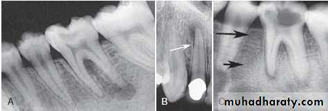 Inflametary lesions of the jaw
