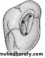 endo