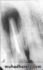 endo