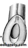 endo