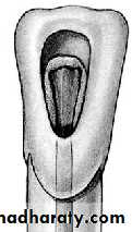 endo