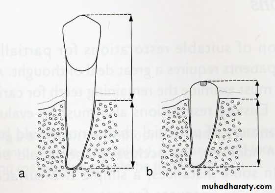 diagnosis and treatment plane for RPD-part 2