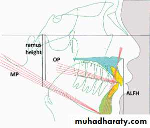 diagnosis and treatment plane for RPD-part 2