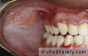 dr asmaa red and white lesions