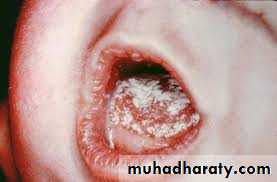 dr asmaa red and white lesions
