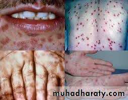 dr asmaa red and white lesions