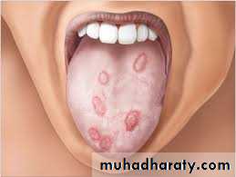 dr asmaa red and white lesions