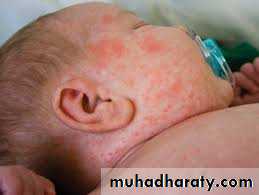 dr asmaa red and white lesions