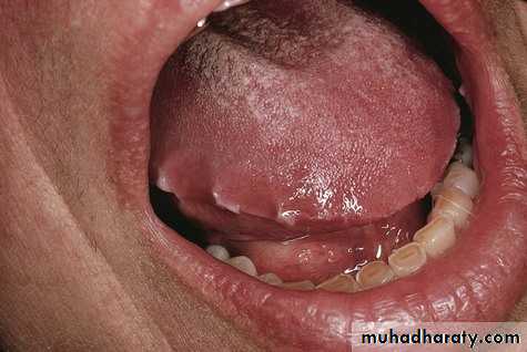 dr asmaa red and white lesions