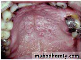 dr asmaa red and white lesions