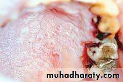 dr asmaa red and white lesions