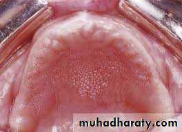 dr asmaa red and white lesions