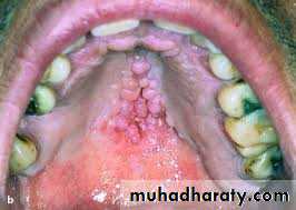 dr asmaa red and white lesions