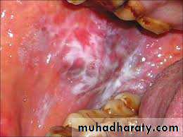 dr asmaa red and white lesions