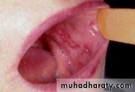 dr asmaa red and white lesions