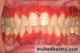 dr asmaa red and white lesions
