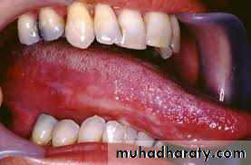 dr asmaa red and white lesions