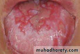 dr asmaa red and white lesions