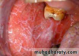 dr asmaa red and white lesions