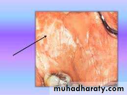 dr asmaa red and white lesions