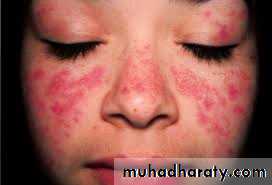 dr asmaa red and white lesions