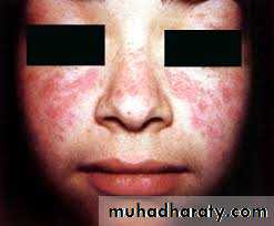 dr asmaa red and white lesions