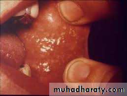 dr asmaa red and white lesions