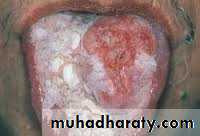 dr asmaa red and white lesions