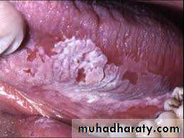 dr asmaa red and white lesions