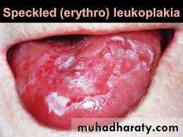 dr asmaa red and white lesions