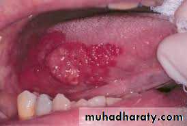 dr asmaa red and white lesions