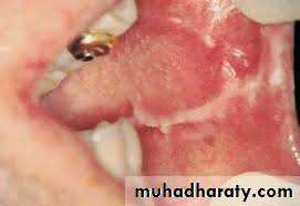 dr asmaa red and white lesions