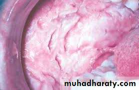 dr asmaa red and white lesions